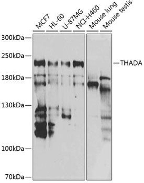 ChIP Antibodies Anti-THADA Antibody CAB7129