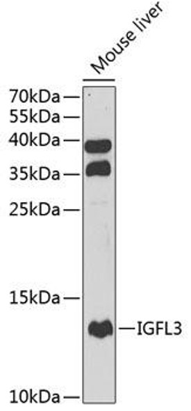 Cell Biology Antibodies 11 Anti-IGFL3 Antibody CAB7154