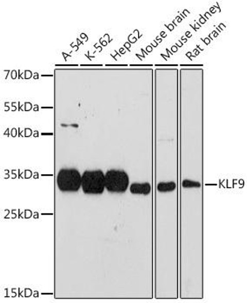 Cell Biology Antibodies 11 Anti-KLF9 Antibody CAB7196