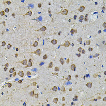 Cell Biology Antibodies 11 Anti-N6AMT1 Antibody CAB7201