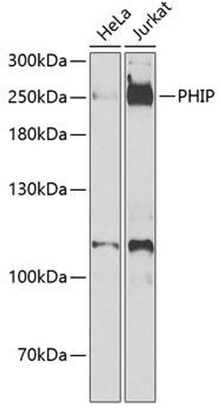 Cell Biology Antibodies 11 Anti-PHIP Antibody CAB7207