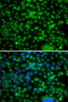 Cell Biology Antibodies 11 Anti-PHYHD1 Antibody CAB7208
