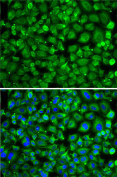 Cell Biology Antibodies 11 Anti-SAT2 Antibody CAB7211