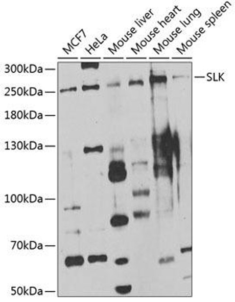 Cell Death Antibodies 2 Anti-SLK Antibody CAB7213