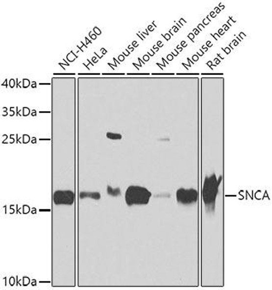 Cell Biology Antibodies 11 Anti-SNCA Antibody CAB7215