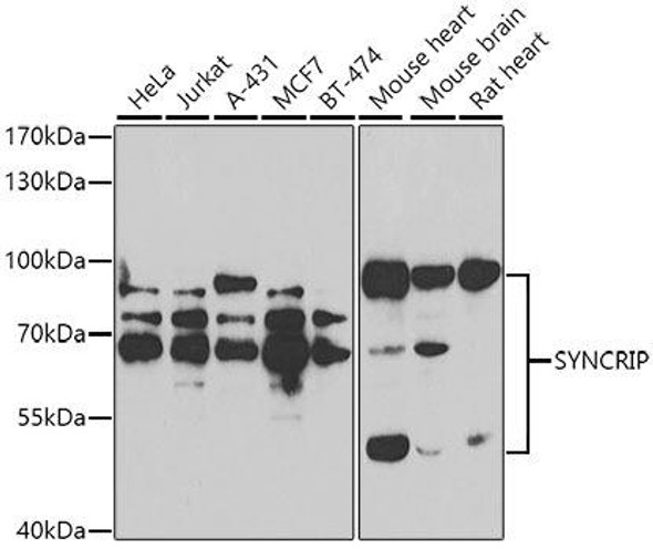 Immunology Antibodies 2 Anti-SYNCRIP Antibody CAB7219