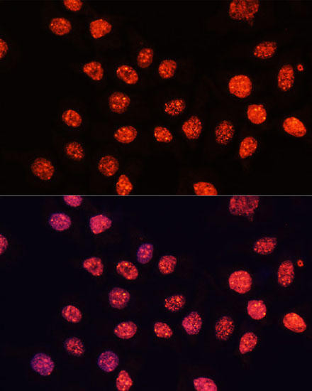 Epigenetics and Nuclear Signaling Antibodies 4 Anti-TriMethyl-Histone H3-K56 Antibody CAB7262