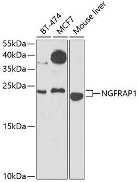 Cell Death Antibodies 2 Anti-NGFRAP1 Antibody CAB7296