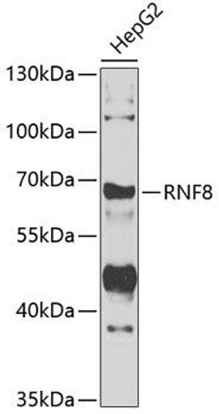 Cell Cycle Antibodies 2 Anti-RNF8 Antibody CAB7302