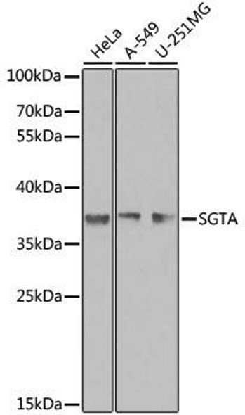 KO Validated Antibodies 1 Anti-SGTA Antibody CAB7306KO Validated