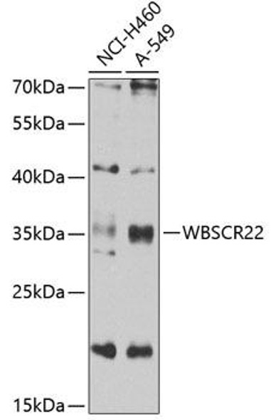 Cell Biology Antibodies 11 Anti-WBSCR22 Antibody CAB7317