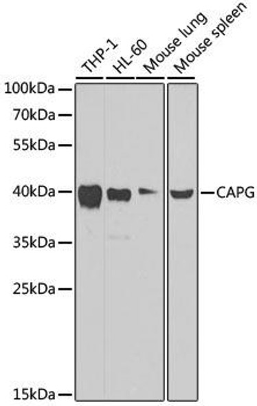 KO Validated Antibodies 1 Anti-CAPG Antibody CAB7324KO Validated