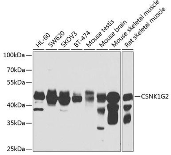 Metabolism Antibodies 2 Anti-CSNK1G2 Antibody CAB7326
