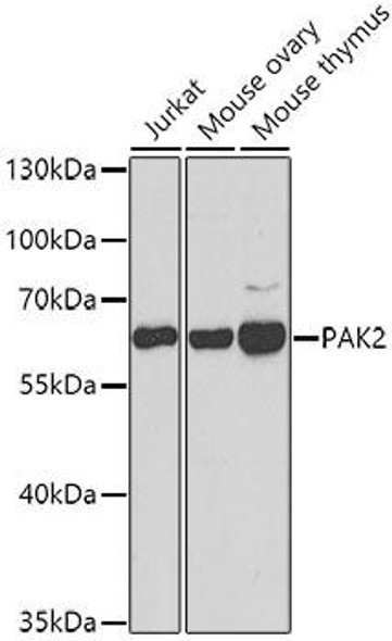 Cell Death Antibodies 2 Anti-PAK2 Antibody CAB7333