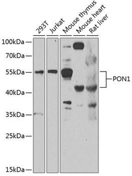 Cell Biology Antibodies 11 Anti-PON1 Antibody CAB7338