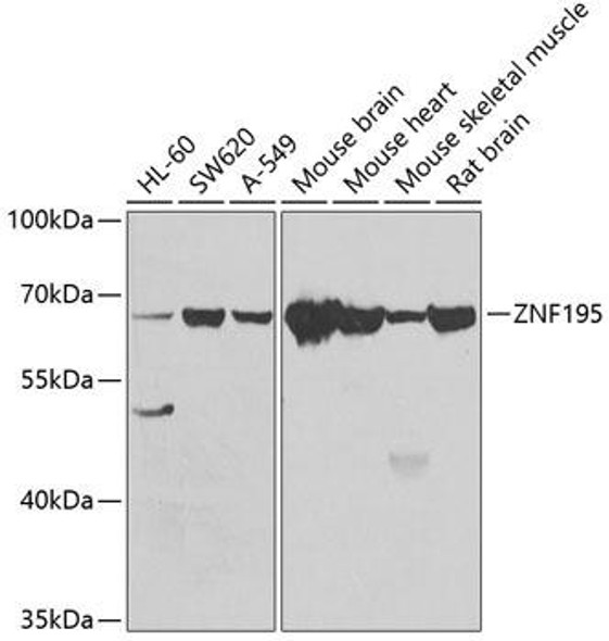 Epigenetics and Nuclear Signaling Antibodies 4 Anti-ZNF195 Antibody CAB7347