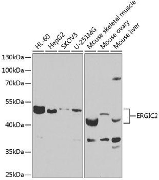 Cell Biology Antibodies 11 Anti-ERGIC2 Antibody CAB7369