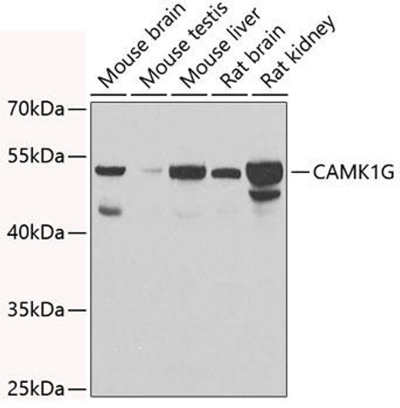 Cell Biology Antibodies 11 Anti-CAMK1G Antibody CAB7379