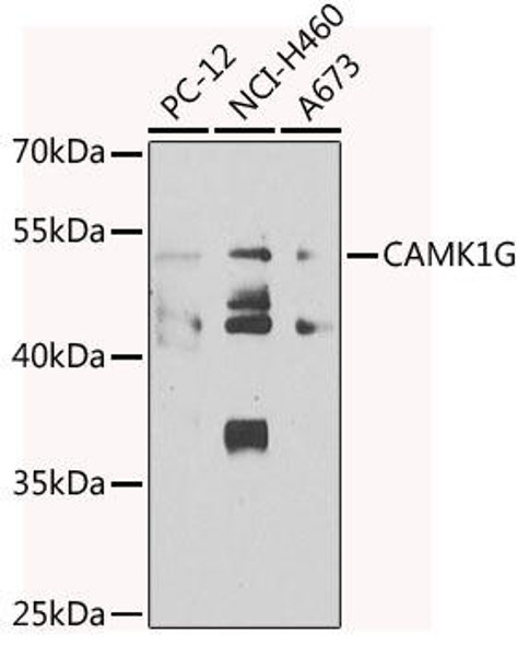 Cell Biology Antibodies 11 Anti-CAMK1G Antibody CAB7379