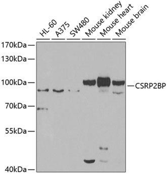 Cell Biology Antibodies 11 Anti-CSRP2BP Antibody CAB7380