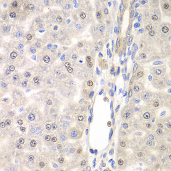 Signal Transduction Antibodies 3 Anti-DTX2 Antibody CAB7398