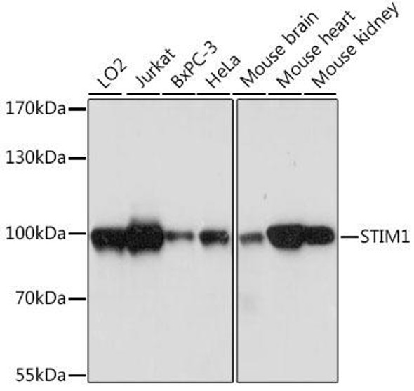 Cell Biology Antibodies 11 Anti-STIM1 Antibody CAB7411