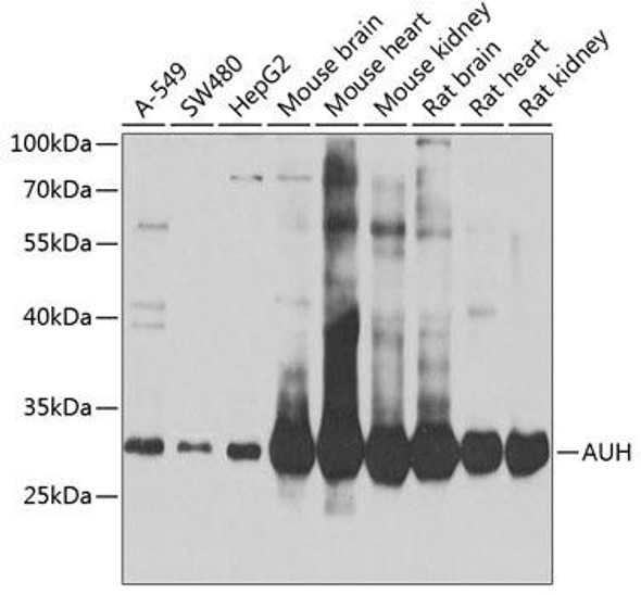 Metabolism Antibodies 2 Anti-AUH Antibody CAB7424