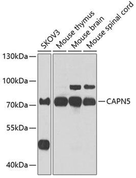 Cell Biology Antibodies 11 Anti-CAPN5 Antibody CAB7428