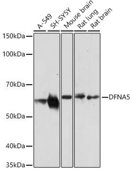Cell Death Antibodies 2 Anti-DFNA5/GSDME Antibody CAB7432