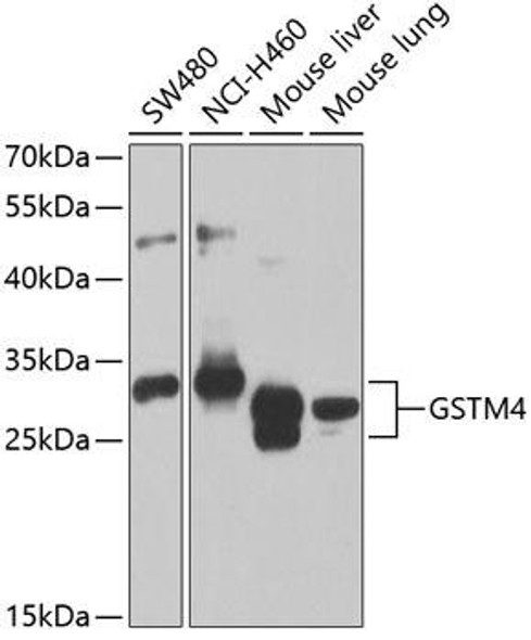 Cell Biology Antibodies 11 Anti-GSTM4 Antibody CAB7434