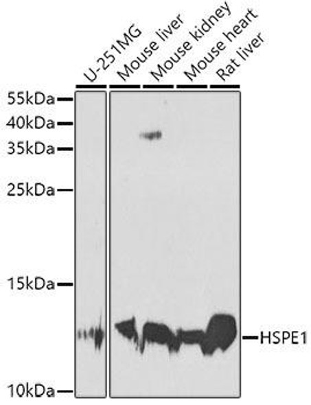 Metabolism Antibodies 2 Anti-HSPE1 Antibody CAB7437