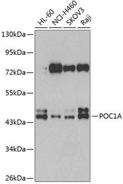 Cell Biology Antibodies 11 Anti-POC1A Antibody CAB7465