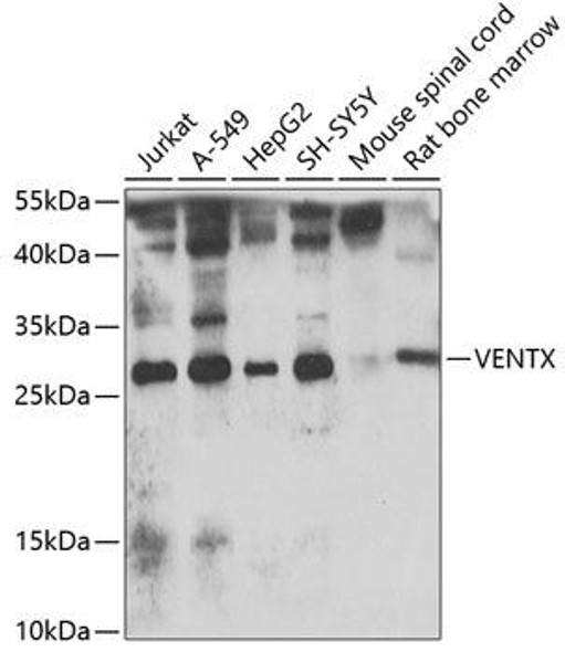 Cell Biology Antibodies 11 Anti-VENTX Antibody CAB7467