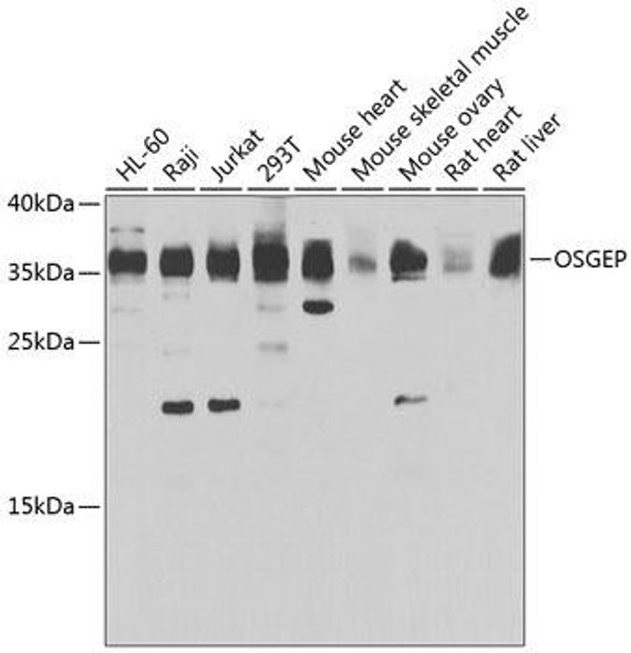 Epigenetics and Nuclear Signaling Antibodies 4 Anti-OSGEP Antibody CAB7473