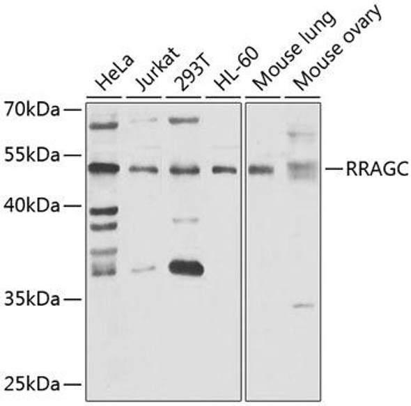 Cell Biology Antibodies 11 Anti-RRAGC Antibody CAB7479