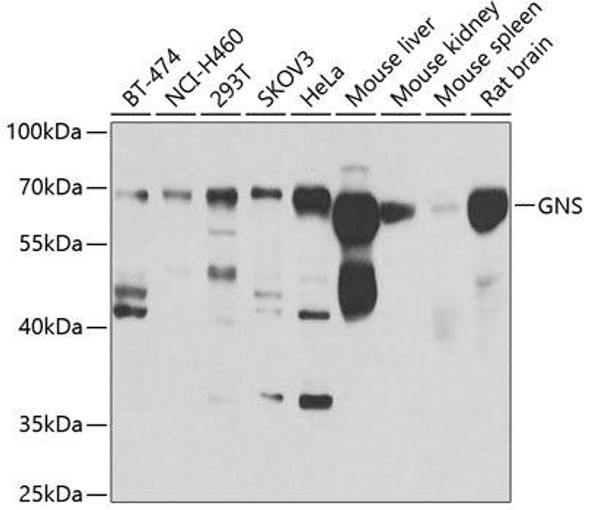 Cell Biology Antibodies 11 Anti-GNS Antibody CAB7489