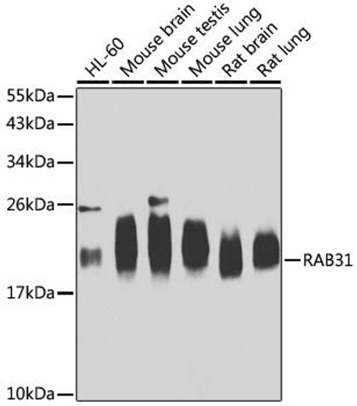 Cell Biology Antibodies 11 Anti-RAB31 Antibody CAB7506