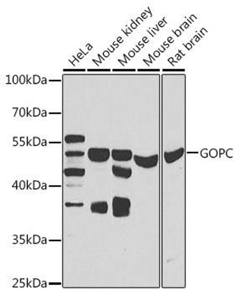 Cell Biology Antibodies 11 Anti-GOPC Antibody CAB7513