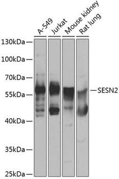 Cell Biology Antibodies 11 Anti-SESN2 Antibody CAB7515