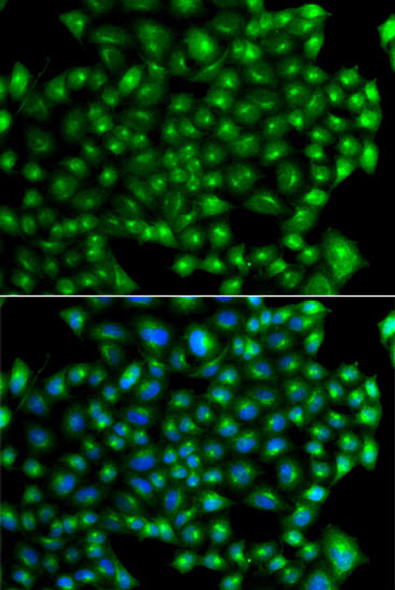 Cell Biology Antibodies 11 Anti-ZFYVE1 Antibody CAB7527