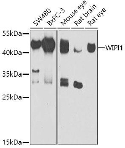 Autophagy Antibodies Anti-WIPI1 Antibody CAB7528