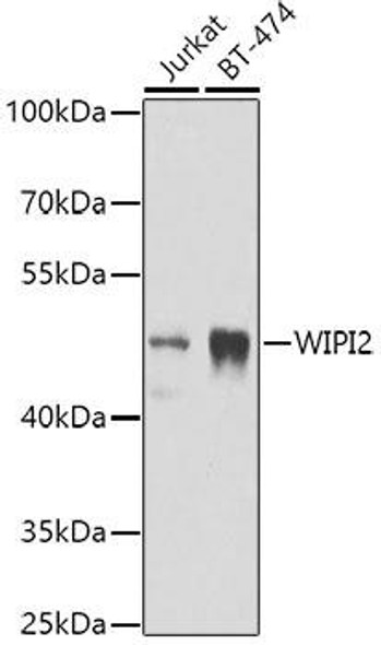 Autophagy Antibodies Anti-WIPI2 Antibody CAB7537