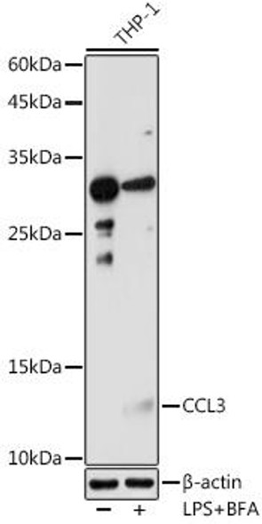 Cell Biology Antibodies 11 Anti-CCL3 Antibody CAB7568