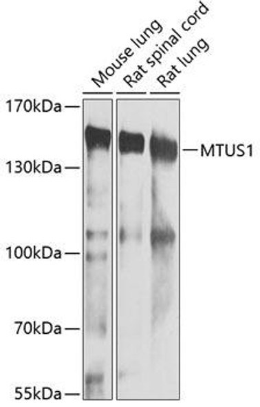 Cell Biology Antibodies 11 Anti-MTUS1 Antibody CAB7601