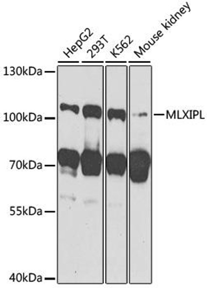 Epigenetics and Nuclear Signaling Antibodies 4 Anti-MLXIPL Antibody CAB7630