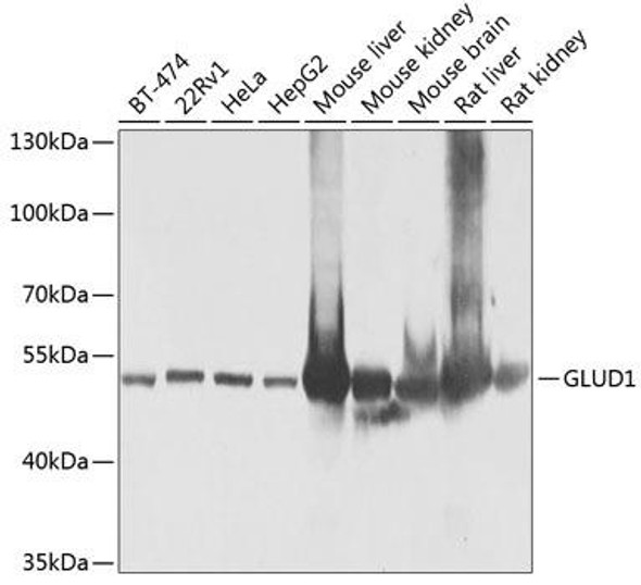 Cell Biology Antibodies 11 Anti-GLUD1 Antibody CAB7631