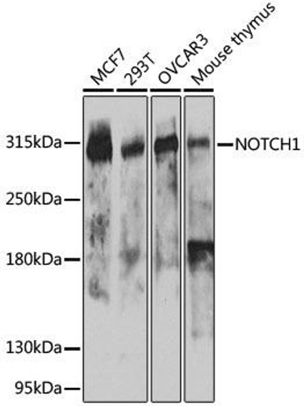 KO Validated Antibodies 1 Anti-NOTCH1 Antibody CAB7636KO Validated