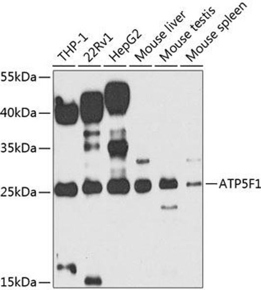 Signal Transduction Antibodies 3 Anti-ATP5F1 Antibody CAB7645