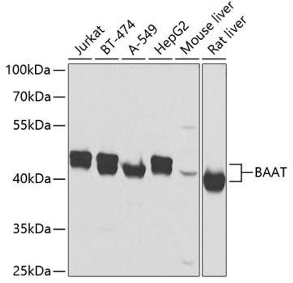 Metabolism Antibodies 2 Anti-BAAT Antibody CAB7646