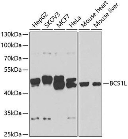 Cell Biology Antibodies 11 Anti-BCS1L Antibody CAB7647